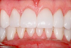 dental images 89119