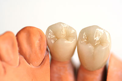 A pair of artificial teeth on display, showcasing the product s design and color.