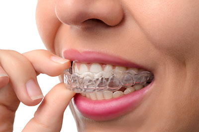 A person with a smile, holding a clear plastic tray containing transparent aligners or dental appliances.