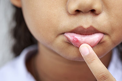 The image shows a close-up of a person s face, with a focus on their lips and chin. They appear to be touching or examining their skin with their finger.